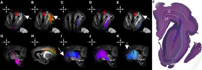 Spatiotemporal Relationship of Brain Pathways during Human Fetal Development Using High-Angular Resolution Diffusion MR Imaging and Histology